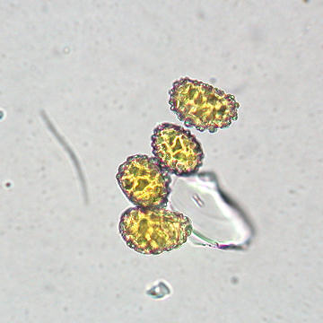 Fern spores