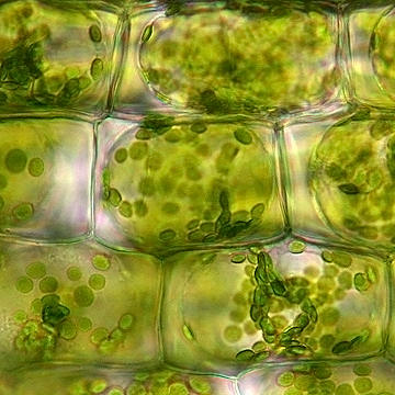 Plasmolysed plant cell